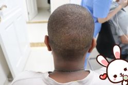 -大麦微针植发丨全国连锁