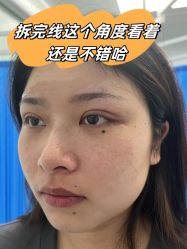 -素美医疗美容·西南眼鼻整形·修复基地