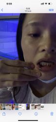 体验后-南昌臻爱医疗美容