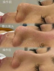 -美愈美肤MEIYU SKIN