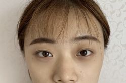 -天津健丽·去眼袋医疗美容机构