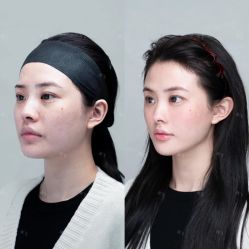 -深圳艺星医疗美容医院