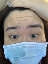 体验前-深圳美莱医疗美容医院