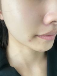 -SKIN79皮肤管理中心