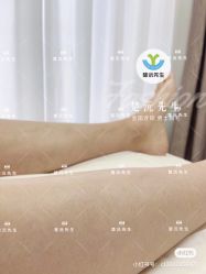 -楚沅先生专业男士脱毛连锁