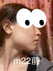 -北京米扬丽格医疗美容·联合丽格鼻整形中心