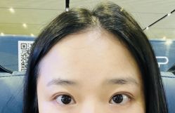 -素美医疗美容·西南眼鼻整形·修复基地