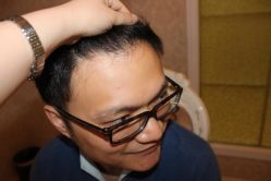 -大麦微针植发丨全国连锁