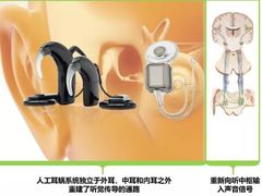 -惠耳听力助听器(霍邱新蓼大道店)