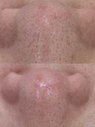 -SKIN79皮肤管理中心