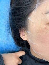 体验后-杭州米兰柏羽医疗美容医院