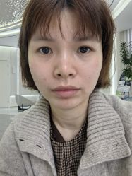 体验前-杭州奥拉克医疗美容门诊部