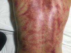 -正宜按摩养生坊(建设局店)