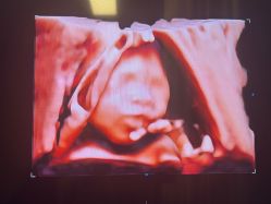 -郑州万安妇产医院