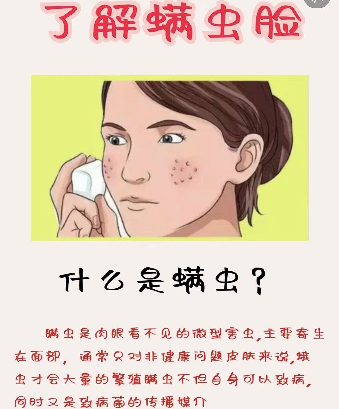 螨虫大多数寄生在毛囊皮脂腺内,以细胞的营养物和汗腺,皮脂腺的分泌物