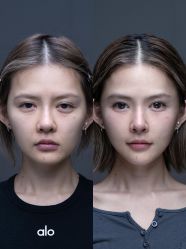 -深圳艺星医疗美容医院