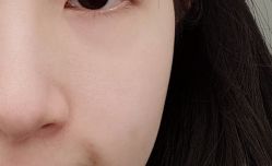 体验后-武汉颜范薇美医疗美容门诊部