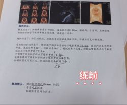 点击看大图 -初练产后康复