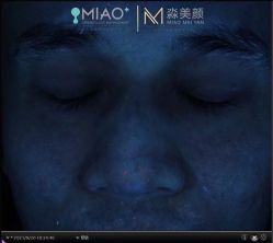 -韩国淼美颜皮肤管理官方直营店