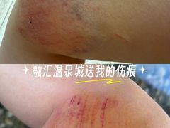 -融汇温泉