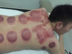 -太乙盲人推拿按摩连锁(星洲店)