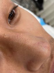 -郡艺医疗美容·微整·眼鼻吸脂