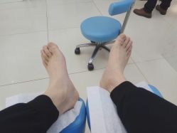 -派恩宜灰指甲鸡眼嵌甲手足癣