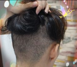 -大麦微针植发全国连锁