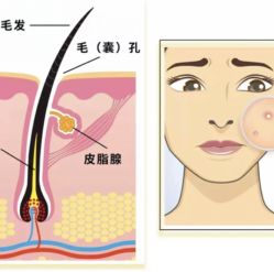 -苗方清颜痘肌研究所