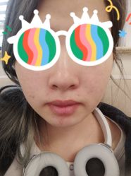 体验前-上海首尔丽格医疗美容医院