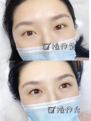 -久匠·纹眉纹绣半永久