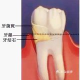 矫牙前做的这个收费项目，不做后果很严重