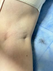 体验前-四川米兰柏羽医学美容医院