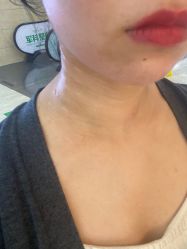 体验前-重庆军科整形美容医院