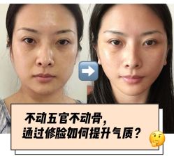 -和颜一美轻医美连锁