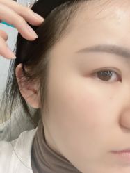 -丰联丽格医疗美容·联合丽格眼整形中心