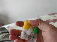 -苏州大学理想眼科医院