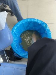 -德哥灰指甲脚气甲沟炎跖疣护理