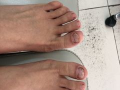 -新甲连锁灰指甲·甲沟炎·鸡眼(黑龙江路店)