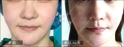 -北京丽星翼美医疗美容