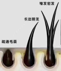 点击看大图 -诗碧曼·头疗养发馆