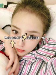 -雍禾植发全国连锁