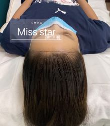 -MISS STAR·半永久纹眉·发际线·美瞳线