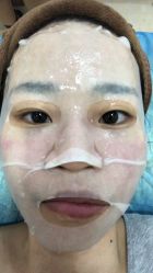 体验后-东莞西妃整形美容医院