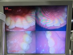 -土豆口腔(凤凰北总店)
