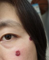 -空军总医院激光整形美容中心