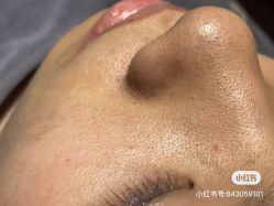 -LUNA皮相美·骨相美高级美感