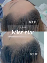 -MISS STAR·半永久纹眉·发际线·美瞳线