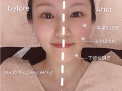 -FACE·日本小颜美容整骨(福田店)