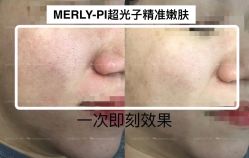 -MLP美丽派·问题肌疗愈中心